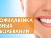 Методы профилактики стоматологических заболеваний