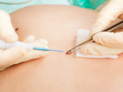 Преимущества хирургического удаления образований кожи