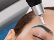 Удалить татуаж бровей лазером в Петербурге — быстро и без боли