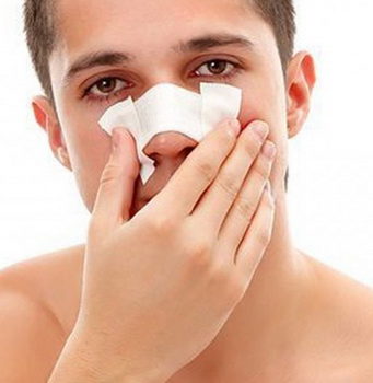 Особенности ринопластики