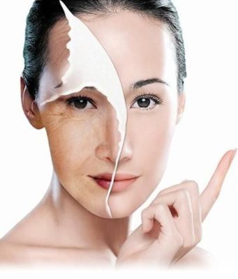 SMAS-лифтинг: плюсы и минусы