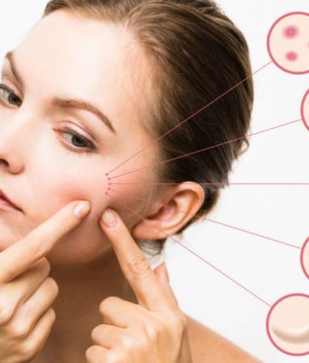 Причины ухудшения состояния кожных покровов