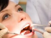 Профессиональное пломбирование зубов от клиники «Никавита»