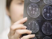 День борьбы с инсультом 2020: какого числа, история и традиции