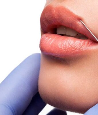 Способы увеличения губ