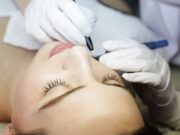 Электроэпиляция лица: преимущества и особенности проведения