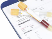 Что такое pro-bnp анализ?