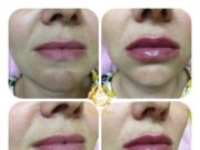 Saypha: эталонный стандарт безопасности в контурной пластике