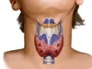 Самые распространенные заболевания щитовидной железы