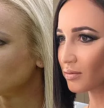 Популярные косметологические процедуры у российских звезд кино