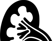 Літотрипсія — 4 причини звернутися до уролога Urologist Valetskyi