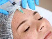 Биоревитализанты — секрет молодости кожи