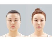 Популярность пластических операций в Корее