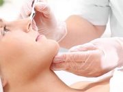 Кому подходит и зачем нужна процедура СМАС-лифтинга