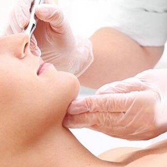 Кому подходит и зачем нужна процедура СМАС-лифтинга