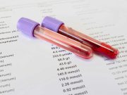 Биохимические исследования крови: что они могут рассказать о вашем здоровье?